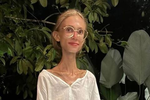 O tânără a fost găsită fără suflare în camera unui hotel din Bali. Turista de 27 de ani consuma doar fructe crude și ajunsese la 22 de kilograme